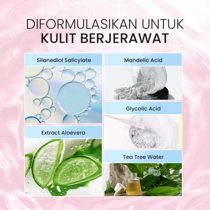 Byzoe Face Spray For Acne Skin Kandungan