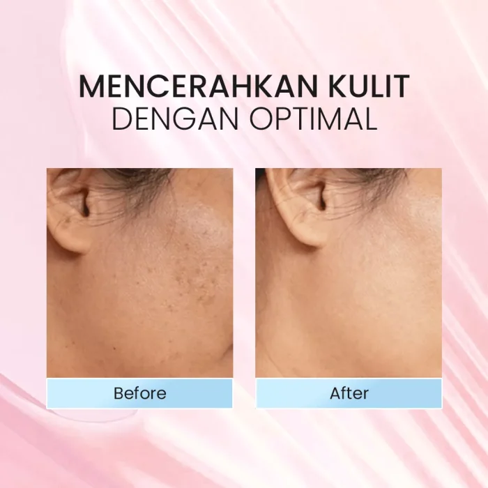 Hiqween Gentle Exfoliating Cream_Before After