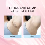 Kanna Underarm Whitening Cream_Before After