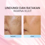 Optimize Shine Perfect Beauty Cream_Before After