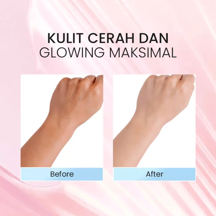 Shaqia Care Premium Whitening Body Lotion_Before After