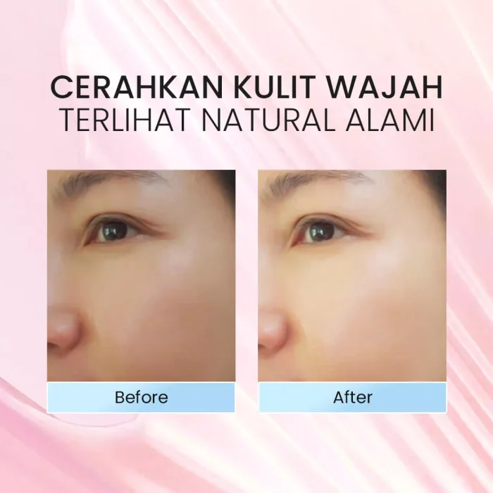 Vestme Whitening Face Serum Before After