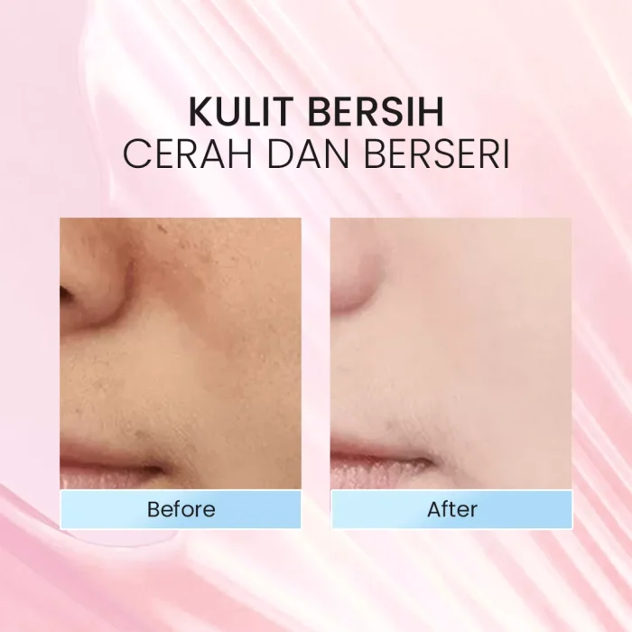 Optimize Shine Beauty Cleanser_Before After