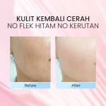 Optimize Shine Whitening Glow Serum_Before After