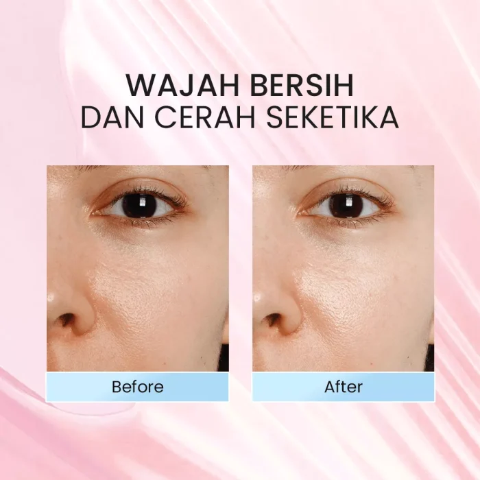 NPURE Face Wash Centella Asiatica Before After