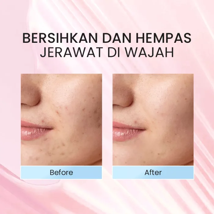 NPURE Facial Toner Centella Asiatica Before After