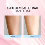 Syahila Care Whitening Body Lotion_Before After