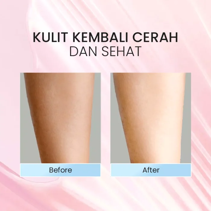 Syahila Care Whitening Body Lotion_Before After