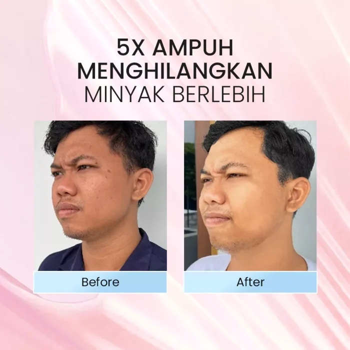 Bromen Everest Cool Sensation Facial Wash Before After