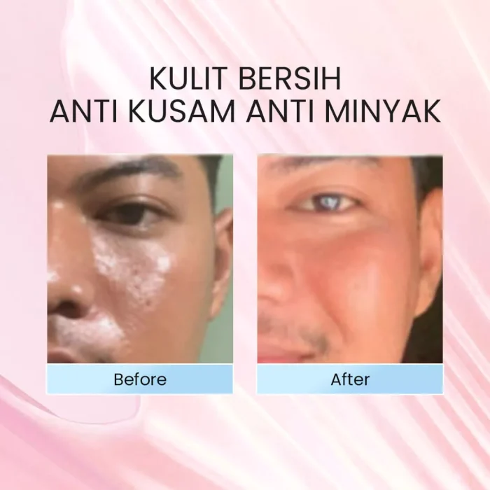 Elvicto Deep Bright Face Wash Before After