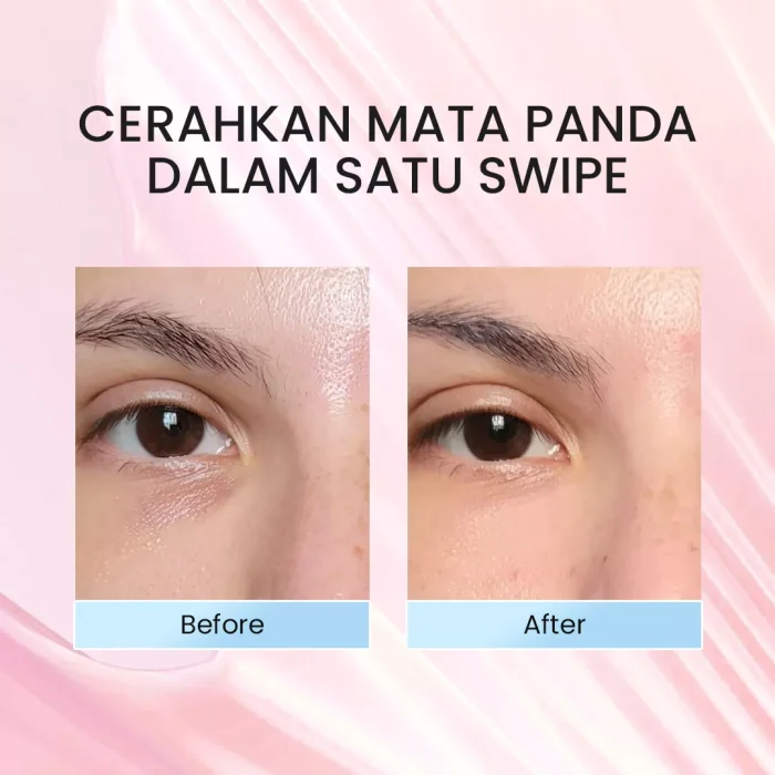 Implora Crystalice Eye Serum _Before After