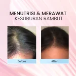 Bonvie Anti Hairfall Kemiri Gin Tonic (60ml) Before After