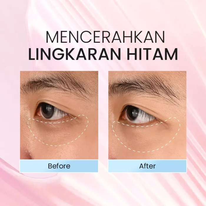 From This Island Bali Green Coffee Espresso Eye Cream_Before after
