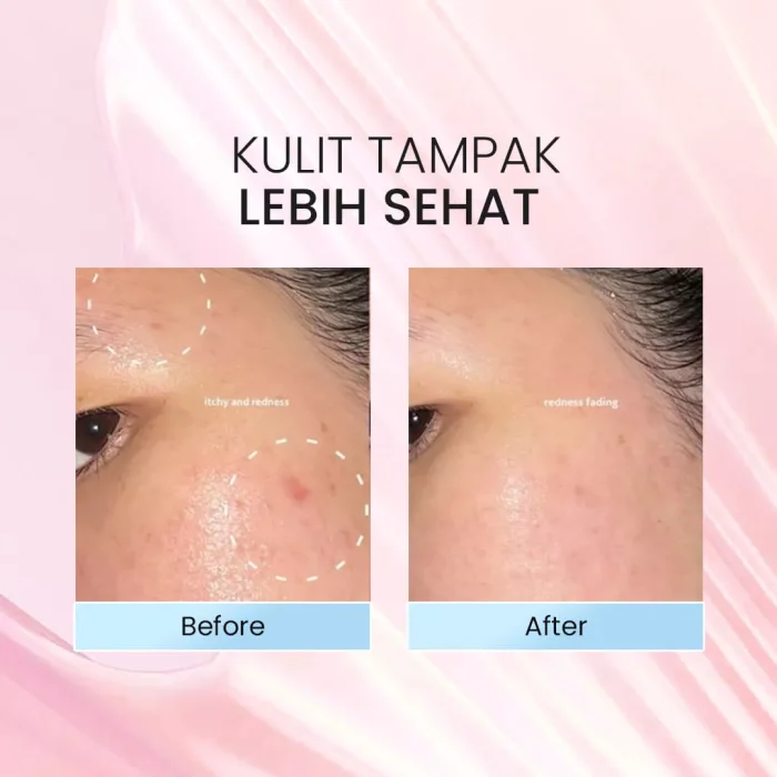 Labore Biome Repair Barrier Revive Cream Before after