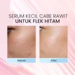 Lacoco Dark Spot Essence Before after