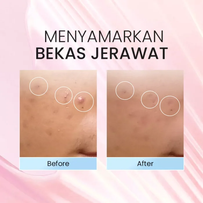 STUDIO TROPIK Brighter Skin Barrier Pudding_Before after
