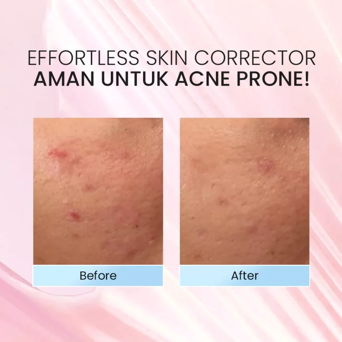 TAVI CICA RES Q10 ADAPTINT SUN SHIELD SPF 50 40ML Before After
