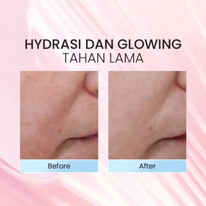 Lacoco Aloe Vera Soothing Mist Before after