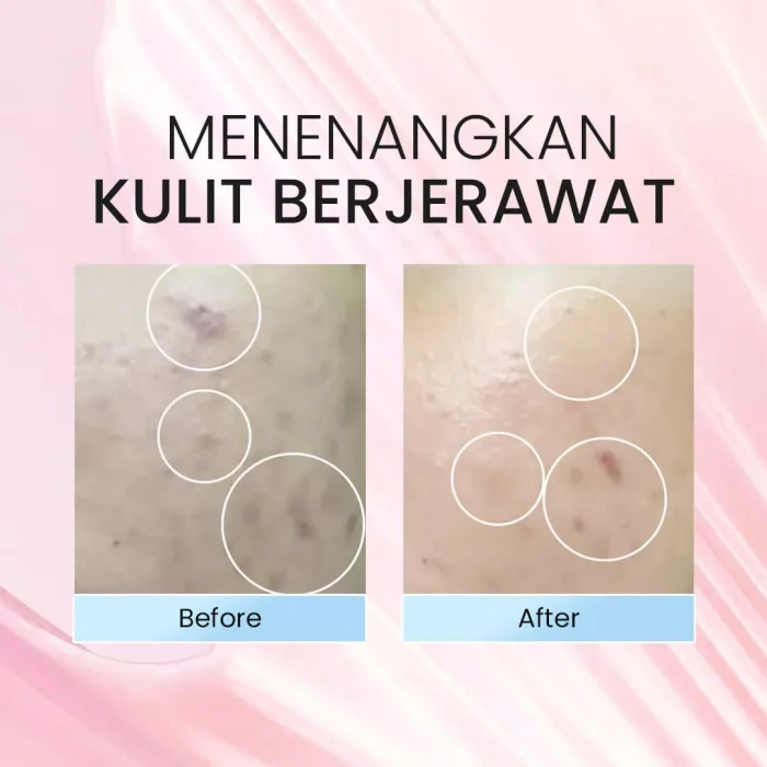 STUDIO TROPIK Fresh Skin Barrier Cream_Before after