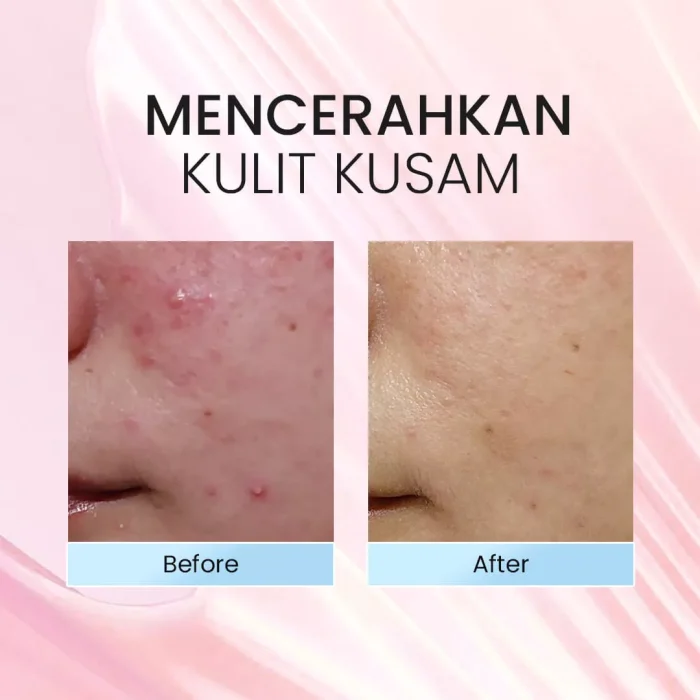 STUDIO TROPIK Pumpkinu Skin Tonic_Before after