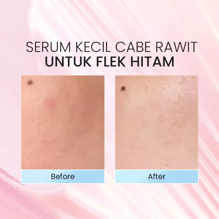 TAVI 1% Encapsulated Retinol + Peptide Slow Aging Signs Serum Before after